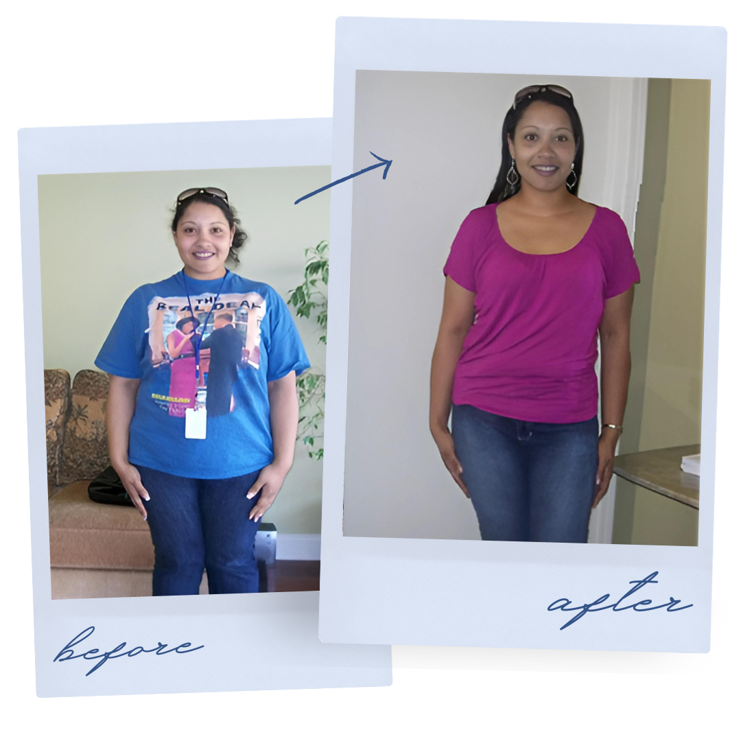 Atlanta Medical Institute patient before and after weight loss result 1