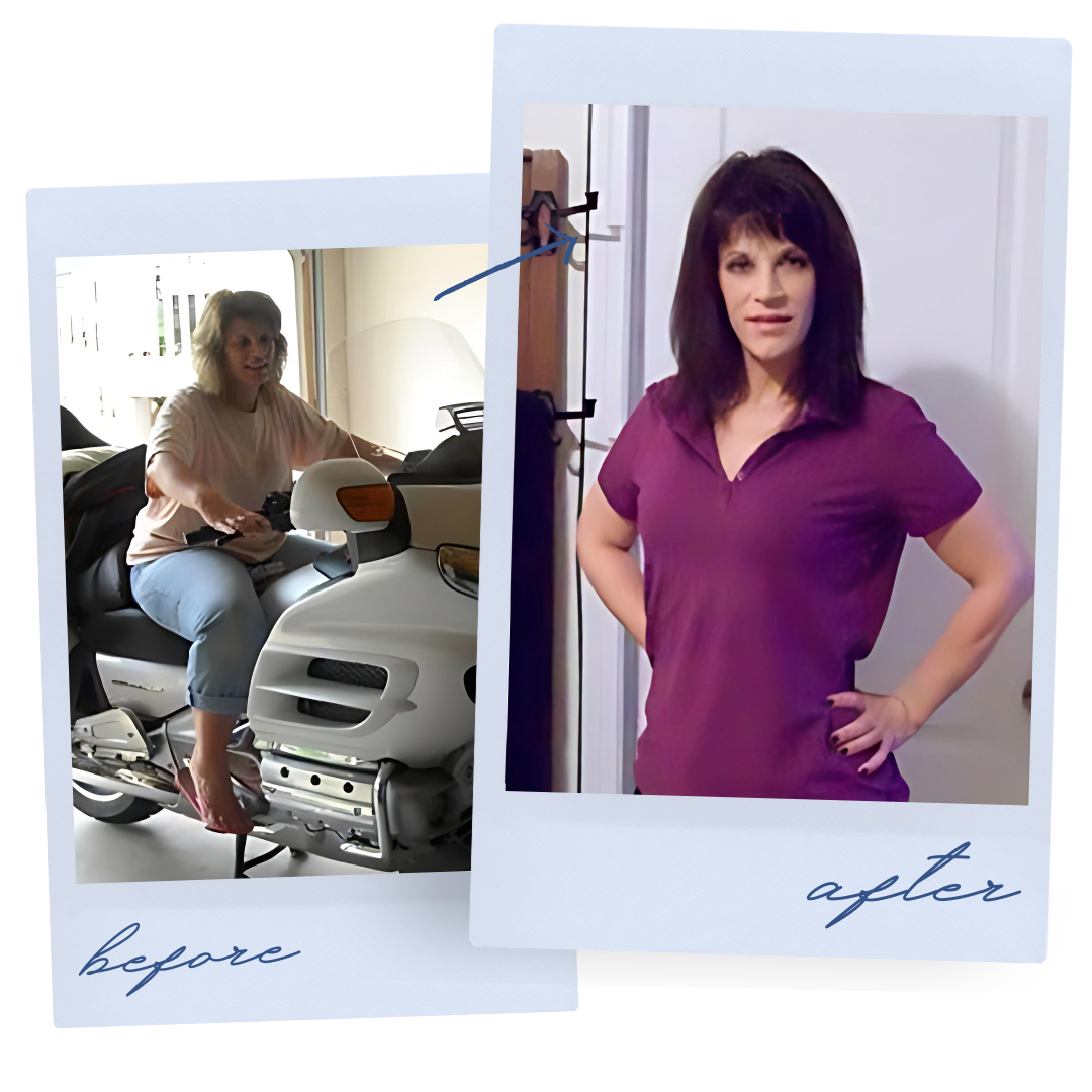 Atlanta Medical Institute patient before and after weight loss result 2