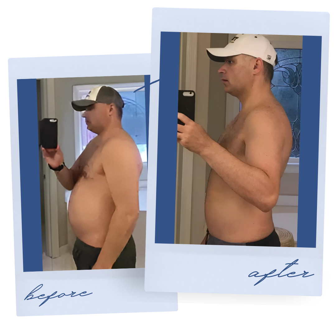 Atlanta Medical Institute patient before and after weight loss result 3